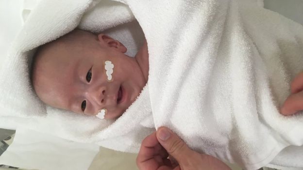 Найкрихітнішого новонародженого хлопчика виписали з лікарні Токіо