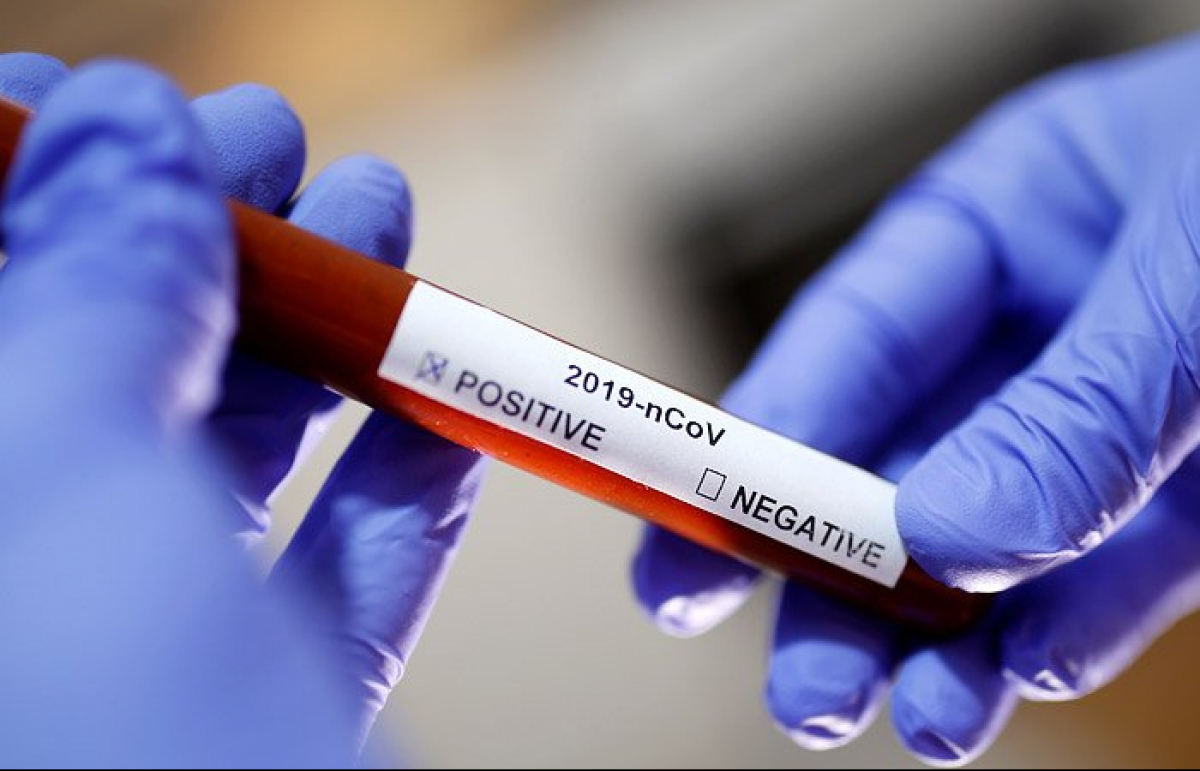 На Волині за добу виявили два нові випадки коронавірусу