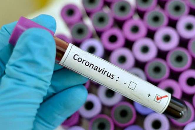 Померлий від коронавірусу волинянин мав супутні захворювання