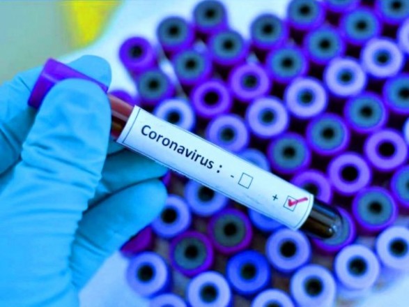 На Волині майже третина осіб, у яких виявляли коронавірус, — медики