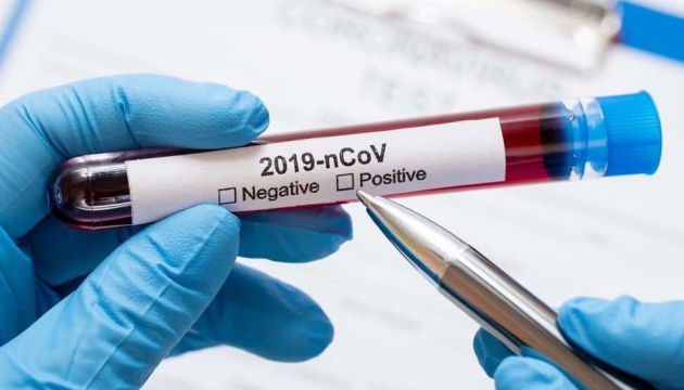 Десятьох волинян оштрафували на 850 гривень за використання підроблених тестів на коронавірус
