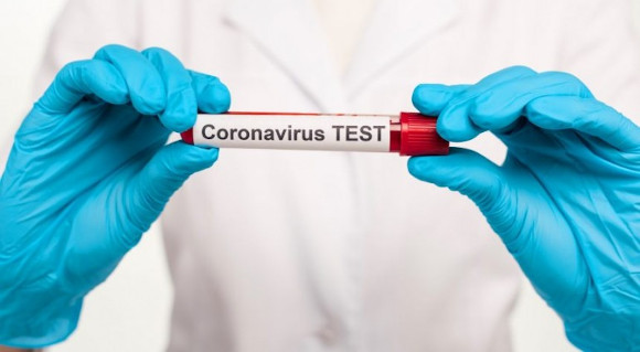 Волинянина підозрюють у причетності до виготовлення підроблених тестів на коронавірус