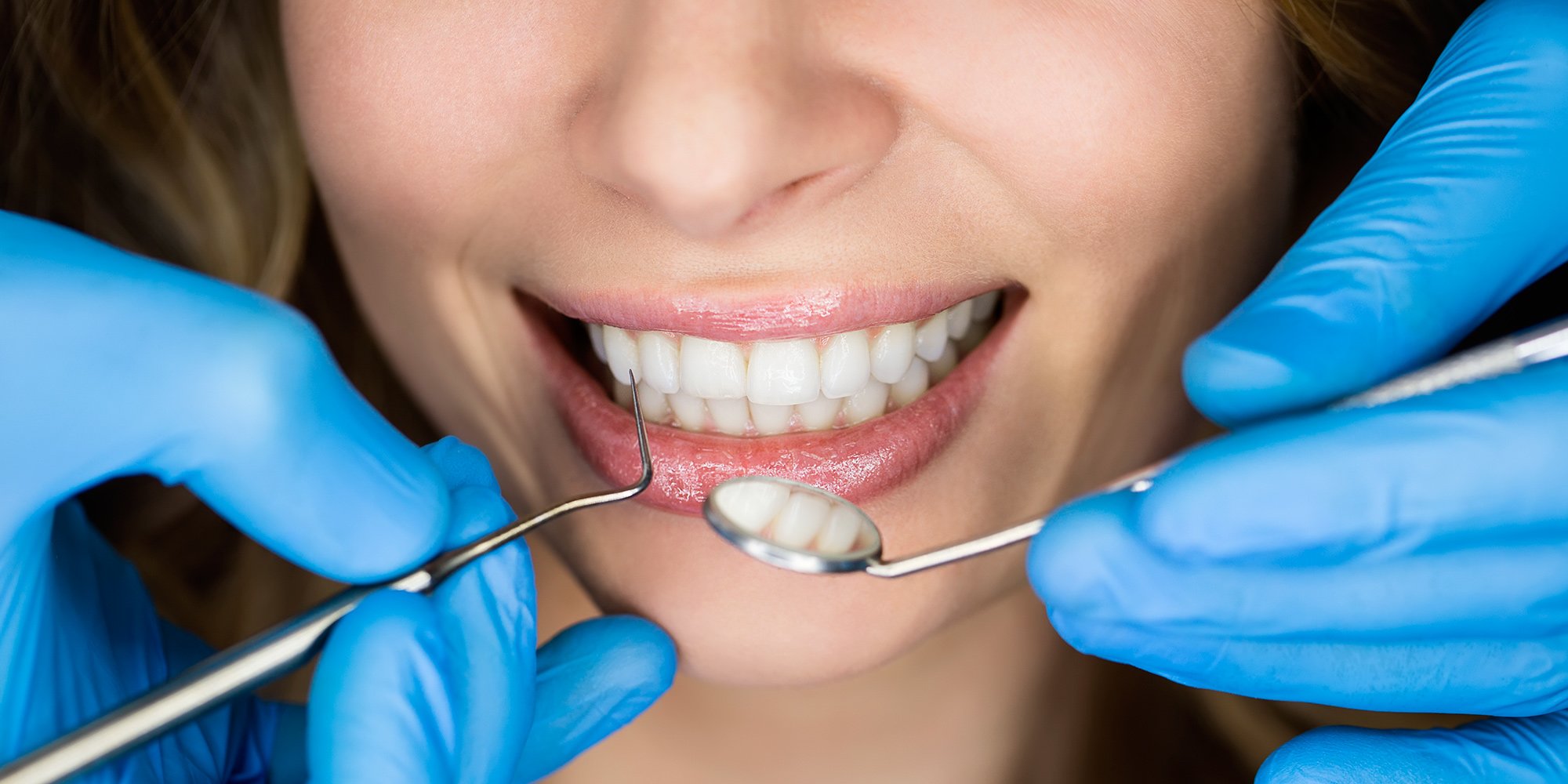 Найкращі виробники імплантів зубів: як вибрати відповідний бренд*